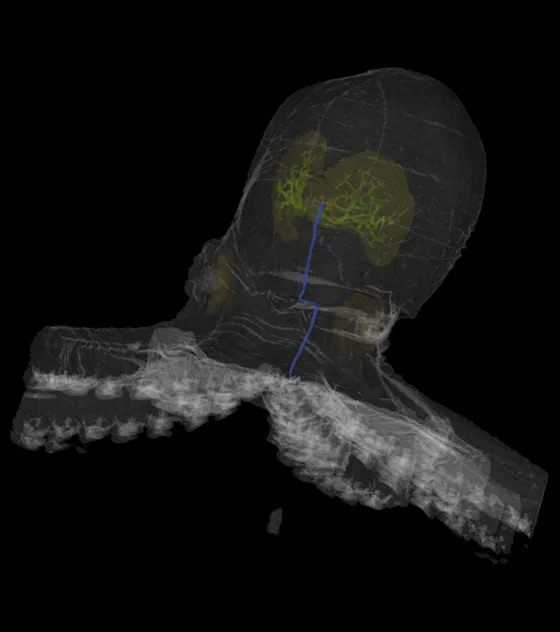 The segmented nerve placed back into the full octopus scan