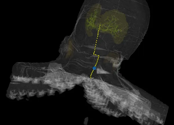 A nerve path traced point by point through a micro-CT scan of an octopus